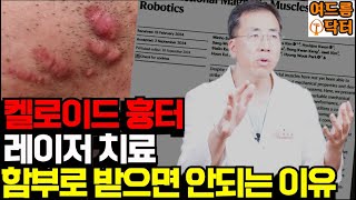 ✨켈로이드 흉터🚨레이저 치료❗️함부로 받으면 안되는 이유 (feat. 여드름 닥터)