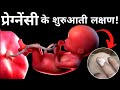 प्रेग्नेंसी के शुरुआती लक्षण! Early pregnancy symptoms | Pregnant hone ke lakshan | hindi