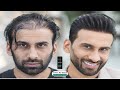 Thinning Haircut (Hair Style for Men) No Hair Toppers, No wigs or Hair Replacement I 2023