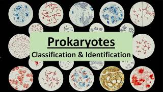 Prokaryote Classification & Identification