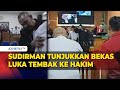 Sudirman Tunjukkan Bekas Luka Tembak Peluru Karet di Depan Hakim saat Sidang PK Terpidana Vina