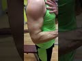 Rupture biceps tendon