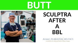Plastic Surgery Truths - Sculptra after a BBL.