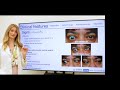 ITAW 2022 - TFI webinar on Thyroid Eye Disease (Dr Roelofs) 28-5-2022