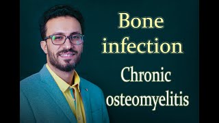 03 Bone infection: Chronic osteomyelitis