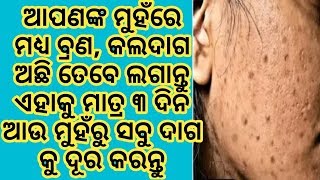 ଆପଣ ମଧ୍ୟ ନିଜ ମୁହଁରୁ ବ୍ରଣ, କଲଦାଗ ଦୂର କରିବାକୁ ଚାହାନ୍ତି ତେବେ ଲଗାନ୍ତୁ ମାତ୍ର ଏହି ଗୋଟେ ଜିନିଷ