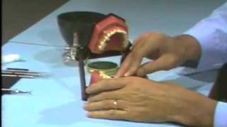 Dental Anatomy: Waxing a Mandibular Bicuspid