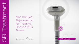 Syneron Elos Plus-effektiv müalicə metodu