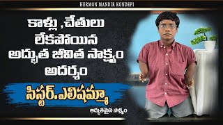 కాళ్ళు చేతులు లేకపోయిన యేసు కోసం అధ్భత సాక్ష్యం #youtube #youtubeshorts #god #songs #jesus