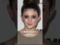 kylie jenner before and after her plastic surgery trending