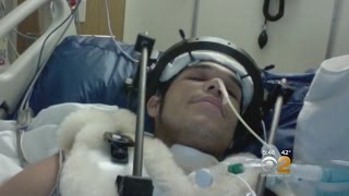 Dr. Max Gomez: Spinal Injury Bypass