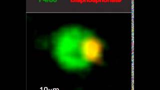 Macrophage devouring calcium-bisphosphonate complex