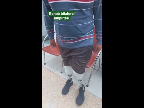 Bilateral #amputee Transtibial Rehab #shorts #bilateralamputee # ...