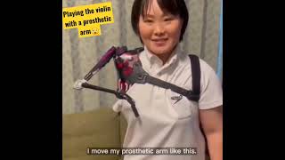 Playing the violin with a prosthetic arm😲 Truly Amazing 🤩 #talent #violin #short