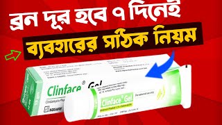 ব্রন দূর হবে 7 দিনেই Clinface Gel ব্যবহারের সঠিক নিয়ম 😱 How To Use Clinface Gel On Face In Bangla