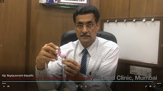 Hip Replacement Marathi | Laud Clinic | Center for Joint Replacement Surgery | Dr Harish Bhende