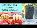 ✔️ 5 Natural Ways to Remove Tartar Buildup & Plaque on the teeth