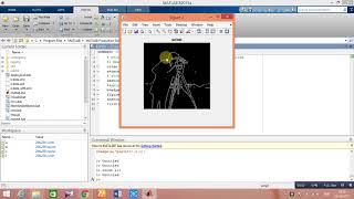 Implementation of Edge detection techniques in Matlab