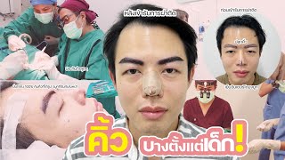 ปลูกคิ้วเสริมโหงวเฮ้งเพิ่มความมั่นใจ กับ BHI Clinic #หมอปุ้ม