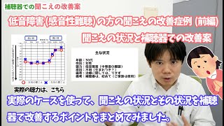 低音障害の聴力の聞こえの実際の改善症例【前編】〜聞こえの状況と補聴器での聞こえの改善案〜