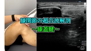 膝関節の超音波解剖(膝蓋腱)