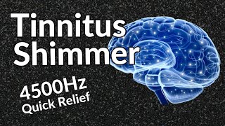 Tinnitus Shimmer - Sound Therapy Relief That WORKS