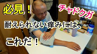 【チャドクガの痒みはこれで治る】～ある庭師の知恵