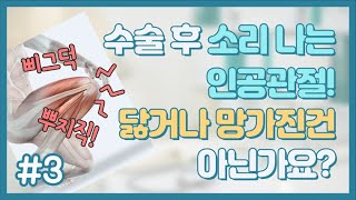 수술 후 소리나는 인공관절! 닳거나 망가진건 아닌가요? [닥터 김용찬의 쓸모있는 관절사전]