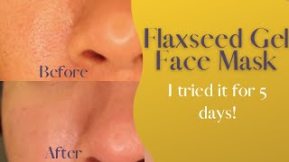 Flaxseed Gel Face Mask | I tried it for 5 days and this happened...