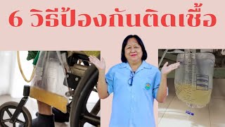 6 วิธีป้องกันการติดเชื้อ ในผู้ป่วยใส่สายสวนปัสสาวะ