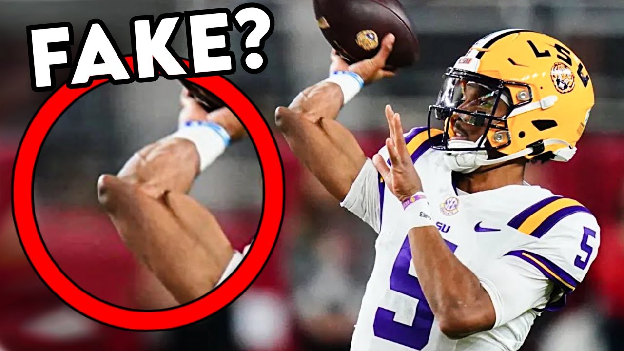 Jayden Daniels Deformed Elbow Is Worrying NFL Fans - Doctor Reacts ...