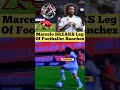 real madrid footballer marcelo breaks leg of sanchez