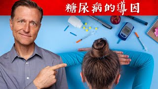 5種會糖尿病的原因,不只吃糖高血糖,還有其他原因,柏格醫生 Dr Berg