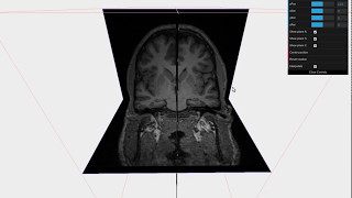 WebGL Ortho plane and obliques of MRI