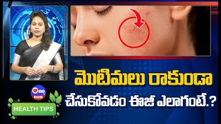 మొటిమలు రాకుండా చేసుకోవడం ఈజీ.. ఎలాగంటే..?