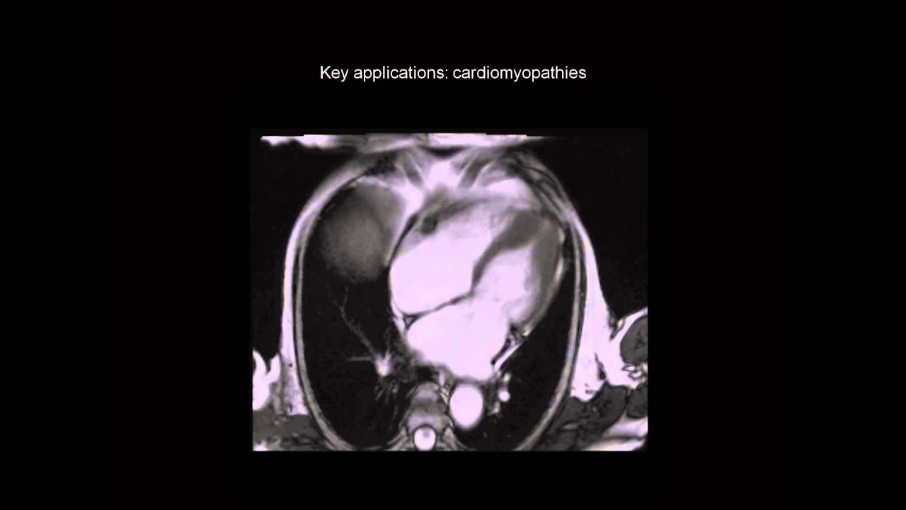 Indications For Cardiac Magnetic Resonance Imaging - YouTube