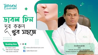 ডাবল চিন দূর করার উপায় | How to Remove Double Chin | Adorn Laser Care