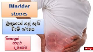 Bladder stones/මුත්‍රාශයේ ගල් ඇති වීම/causes/how it happens/treatment/sinhala/how to prevent