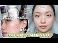 Bekas Jerawat hilang dalam 15 hari! 😍 SKINCARE LOKAL TERJANGKAU - ACNE PRONE SKIN