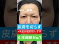 60代女性に奇跡の若返り 目の下のクマ取りたるみ取り美容整形 予約は☎️0120489100 美容整形 目の下のたるみ 目の下のくま くまとり クマ取り 目の下のクマ shorts