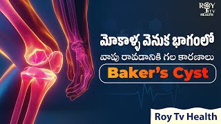 Symptoms Of Baker's Cyst on Knee in Telugu | మోకాళ్ళ వెనుక వాపు | HEALTH TIPS | ROY TV HEALTH