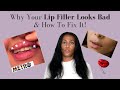 What Makes Lip Filler Look Bad | How To Fix Lip Filler Problems | Top Lip Filler Tips