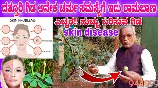 ದತ್ತೂರಿ ಗಿಡ ಚರ್ಮರೋಗಗಳಿಗೆ ಉಪಕಾರಿ Skin disease, poison plant |ಉಮ್ಮತ್ತಿ, Datura Stramonium, Jimson Weed