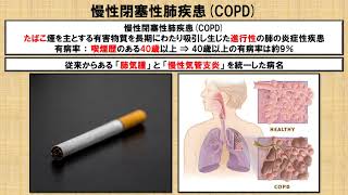 閉塞性換気障害の種類及び病態に関する知識  ①！？ 慢性閉塞性肺疾患COPD ～No. 69 理学療法士国家試験対策　シリーズ～