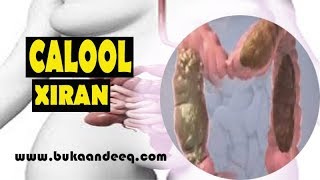 calool xiran | saxarada oo ku adkaata qofka | constipation