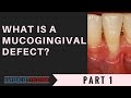 What is a MUCOGINGIVAL defect? PART 1