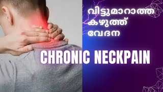 വിട്ടുമാറാത്ത കഴുത്ത് വേദന Neck Pain#physiotherapy #exercise