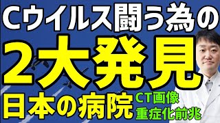 サイレント肺炎 　CのCTと重くなる兆し　日本が大発見した真実