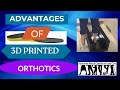 The Advantages of 3D Printed Orthotics