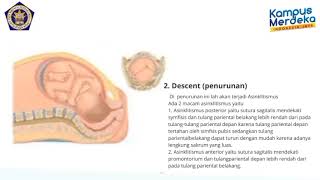Mekanisme Tahapan Penurunan Kepala Janin